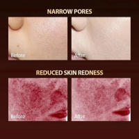 Máscara De Láser LED De Silicona Recargable Para El Rostro Con 7 Colores Terapia Fotónica Belleza Rejuvenecimiento De La Piel Blanqueamiento Levantamiento Facial USB - details 5