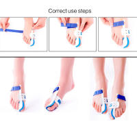 Corrector De Tornejo Ortopédico Para Aliviar El Dolor En El Pie Herramienta De Cuidado Del Pie Corrección De Hallux Valgus Tamaño a Pair Material ABS - details 9