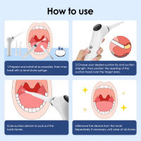 Kit De Eliminador De Pedrascas Adenoides Electrónico Con Luz LED 3 Modos De Succión Limpieza Oral Herramienta De Limpieza De La Boca Cuidado De La Salud Oral - details 7