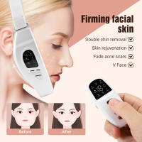 Dispositivo Multifuncional Para Adelgazamiento Del Rostro Y Levantamiento V Shaped Con Compresión Caliente Y Masajeador De Vibración Para El Rostro Control Remoto Rechargeable Material ABS - details 5