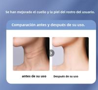 Perfecto para Ella - Tecnología Avanzada y Diseño Premium para Cuero Radiante Masaje Facial y Cuello 2025-Reafirmante Device with 3 Modos, Gift - details 12