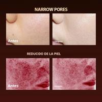 Máscara De Luz LED Para El Rostro 7 Colores Terapia De Silicona Photon Máscara De Belleza Para Levantar La Cara Anti Engrasado Control De Aceite Blanqueamiento Y Reparación De Piel - details 5