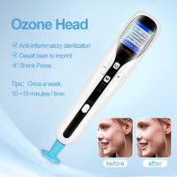 Plasma Pen De Ozono Profesional 2 En 1 Para Eliminar Manchas Y Levantar Piel Facial Y Párpados Recargable Anti-Acné Y Lifting - details 3
