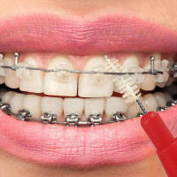 50/100Pcs Cepillos Interdentales Suaves Para Cuidado Oral Herramienta De Limpieza Entre Dientes Para Adultos Plástico No Electrónico - details 0