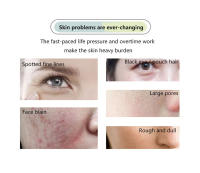 Dispositivo De Cuidado Facial Cryotherapy Máquina De Belleza Con Láser Azul Tratamiento De Acné Masajeador Facial Elevación Rejuvenecimiento Skin Lifting Rejuvenecimiento Belleza - details 2