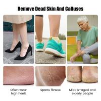 Herramienta De Pedicura Eléctrica Profesional Exfoliador Y Pulidora Para Callos De Pies Eliminador De Piel Muerta Cuidado Y Reparación Del Sandíster - details 1