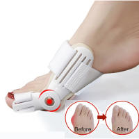 Corrector De Bollo Hallux Valgus Protector De Dedos Ajustable Ortopédico Separador De Dedos Grande Del Pie Fijador De Pies - details 9
