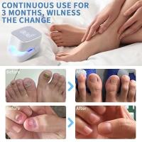 Dispositivo de lámpara de limpieza de hongos de uñas, solución de uso eficaz para uñas gruesas y decoloradas dañadas, para uso doméstico, eliminador de hongos de uñas recargable - details 3