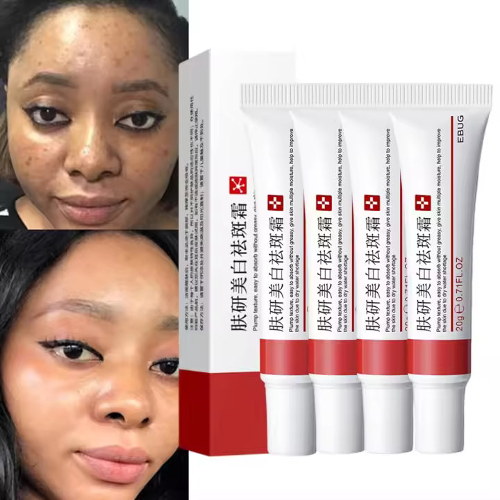 Crema para Manchas Oscuras en La Cara, Cremas para Quitar Manchas de La Cara, Crema para Manchas en La Cara Y Pecas, Crema para Limpiar Las Manchas de La Cara Para Hombres Mujeres (4Piezas) - 1
