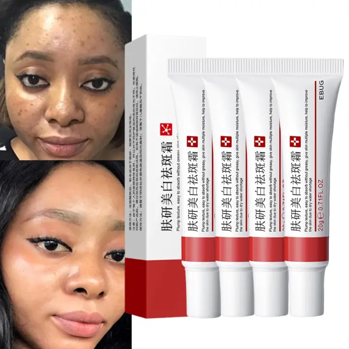Crema para Manchas Oscuras en La Cara, Cremas para Quitar Manchas de La Cara, Crema para Manchas en La Cara Y Pecas, Crema para Limpiar Las Manchas de La Cara Para Hombres Mujeres (4Piezas) - 1