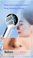 Eliminador de Puntos Negros y Espinillas Recargable por USB NIJ - Aspiradora Eléctrica Facial con Ciclo de Agua, Batería de Litio de 300mAh - details 12