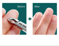 Tijeras De Cutícula MR.GREEN Acero Inoxidable Afilador De Piel Muerto Herramienta De Trimmer Tijeras De Manicura Con Pinzas - details 3