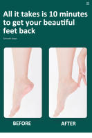 Kit profesional de pedicura 8/10 en 1, afeitadora de callos de acero inoxidable, herramientas para el cuidado de los pies, conseguir pies suaves y lisos - details 9