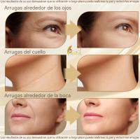 MISTIK  Equipo Masajeador Rejuvenecimiento Facial Papada Arrugas Piel Lifting Antienvejecimiento Hidratacion Con Serum Acid Hyaluro Acne Colageno Belleza Mujer Cara Cuello Papada Terapia con EMS 42° Temperatura Vibracion Sonica Led MISTIK BEAUTY MADRID - details 3