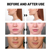 Dispositivo De Belleza EMS V-Face Masajeador Eléctrico Inteligente Para Modelar La Cara Y Eliminar El Doble Mentón Con Carga USB Herramienta Para Delgazar La Cara - details 4