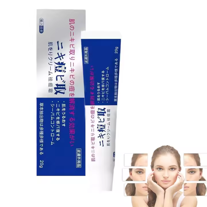 Crema para el acné Lion Pair, 20 g, Japón, gel natural para el acné, para rostro, mujeres y hombres (1) - 1