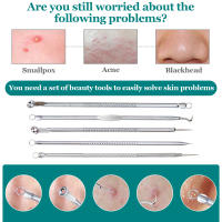 Herramienta De Limpieza De Pores Y Remoción De Acné Con Agujas Para Eliminar Quistes Y Manchas En La Piel Set De 5/8 Piezas - details 1