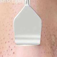 Extructor De Puntos Negros Y Acné De Acero Inoxidable Doble Punta Herramienta Multifuncional Para El Rostro Eliminador De Comedones - details 6