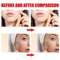 200pcs Parches De Estrella Para Acné Invisibles Eliminador De Manchas De La Piel Hidratante Y Aclarador Para El Rostro Herramientas De Belleza Y Cuidado De La Piel - details 12