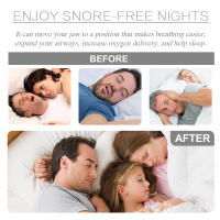 Protector De Sueño South Moon Anti Snore Piecesa Para Dormir Parar El Ronquido Dispositivo Para La Calidad Del Sueño Bruxismo Mordida En Descanso - details 5