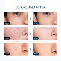 Máquina De Luz LED Para Cuidado De La Piel Con 112 Granos De Luz 7 Colores Máscara Facial Hogar SPA De Alta Energía Para Cuerpo Y Cuello - details 17