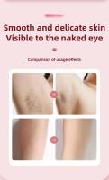 Afeitadora Corporal Para Mujer Recargable USB Eliminación De Pelo Painless Trimmer Para Cara Piernas Axilas Y Bikini Afeitadora De Pubis - details 10