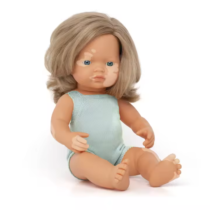 Muñeca caucásica rubia oscuro con vitíligo 38cm - 1