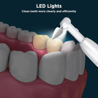 Limpia Tartar Dental Ultrasonica Limpiador De Placa Y Calcular Electrico Blanqueador De Dientes Eliminador De Tartar - details 3
