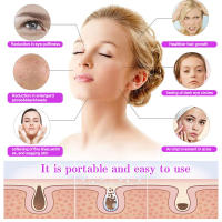 Tratamiento Profesional De Acné Facial Terapia De Alta Frecuencia Portátil Linterna De Mano Herramienta De Cuidado De La Piel - details 1