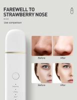 Limpia Puntos Negros Con Espátula Facial Hidratante 4 Modos Herramienta Profunda Limpieza Cutánea Remover Blackhead Skin Scrubber - details 6