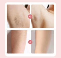 Rasuradora Eléctrica Para Mujer 2 En 1 Trimmer De Bikini Y Pelacabello Para Axilas Y Piernas IPX7 Impermeable Carga Rápida Recargable - details 6