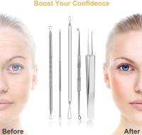 Kit Profesional De 9 Piezas Para Eliminar Quistes Y Puntos Negros Con Pinzas De Acero Inoxidable Y Estuche De Viaje Para Extractor De Acné Para Rostro Y Nariz - details 6