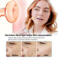 Dispositivo De Terapia Electrolítica De Alta Frecuencia Y Microcorriente Portátil Para Eliminación De Acné Y Belleza - details 3