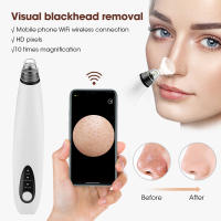 Dispositivo Absorbente para Quitar Puntos Negros Herramienta de Cuidado Facial para Piel Normal Limpieza Profunda en Casa y Salón de Belleza - details 2