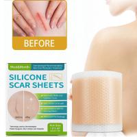Cinta De Reparación De Marcas Silicone Gen 1 Para Rostro Y Cuerpo Eliminación De Acné Cuidado De La Piel Sin Electricity - details 2