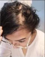 Kit Reviving para Crecimiento del Cabello - Cuidado capilar - Farmasi - Dr. C. Tuna - details 0