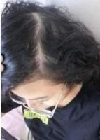 Kit Reviving para Crecimiento del Cabello - Cuidado capilar - Farmasi - Dr. C. Tuna - details 1