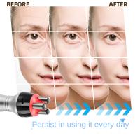 Cecodadi-Máquina profesional de cavitación ultrasónica 40khz, moldeado del cuerpo, liposucción y adelgazamiento - details 13