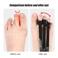 Splint Para Dedos Alivio Del Dolor De Fascitis Plantar Para La Curación De Arco Plano/Tendinitis De Acoldeón/Peroneo/Quelas - details 5