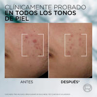L'ORÉAL Paris | Rutina Men Expert Derma Control Gel Limpiador Purificante con Ácido Salicílico y Niacinamida Para Pieles Grasas con Tendencia Acnéica. +  Derma Control S.O.S Pimple Paste Solución Anti-impefecciones + Sérum Anti-Imperfecciones - details 1