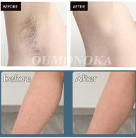 Epilador Láser Inalámbrico 4-en-1 Para Mujer Peluca Piel Permanente IPL Photoepilator Eliminación De Vello Painless Máquina De Epilación Eléctrica Para Bikini Cuerpo Cara Y Axilas - details 15