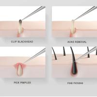 Tweezers Especiales Para Quitar Punzones Y Acné Ultra Fina De 5 Células Herramienta Cosmética Para El Hospital Para Extraer Blackheads Y Punzones Cercanos - details 6
