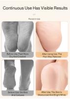 1 Pares De Calcetines De Silicona Suave De Cintura Alta Antifugas Para Playa Zapatillas De Natación Y Diving Sumergibles Para Mujer - details 4