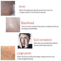 Rodillo De Volcanico Natural Para Absorber Aceite Facial Herramienta De Cuidado De La Piel Massaje Corporal Limpiador De Poros Rollo Facial - details 3