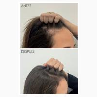 Moncho Moreno Tratamiento Rapunhair Serum Capilar de Crecimiento + Fuerza 70ml - details 1