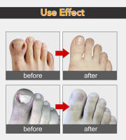 1Pcs Cortauñas Plancha De Toenails Plata Herramienta De Manicura Y Pedicura Para Eliminar Piel Muerta Con Corte De Uña Y Clipper - details 5