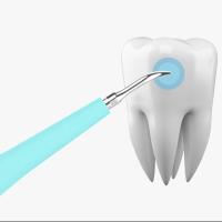 Limpieza Dental Eléctrica Portátil Escáner Sonic Calce Y Manchas De Calcio Eliminador Herramienta Blanqueamiento De Dientes Higiene Oral Para Adultos - details 5