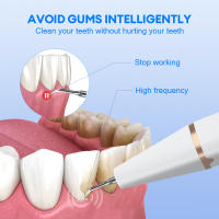 Limpieza Dental Ultrasonica Eliminador De Calcar Y Placa Escáner Dental Eléctrico Blanqueador De Dientes Para Adultos Recargable - details 2