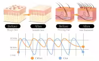 Máquina De Facial De Alta Frecuencia Darsonval Con 6 Brocas De Neón Y Argón Terapia De Piel Elimina Arrugas Y Acné Instrumento De Terapia Facial - details 1