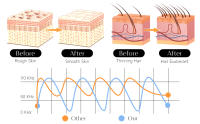 Máquina Facial De Alta Frecuencia Darsonval Con 6 Brocas De Neón Y Argón Terapia De Piel Elimina Arrugas Y Acné Tratamiento Facial - details 1